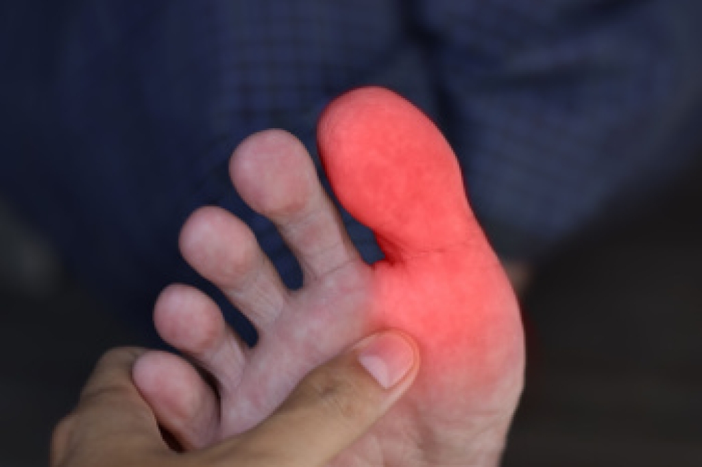 What Can Cause Swelling in a Toe?